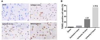 Plasma Exosomal miRNA-122-5p and miR-300-3p as Potential Markers for Transient Ischaemic Attack in Rats